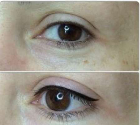 Permanent Eye Liner