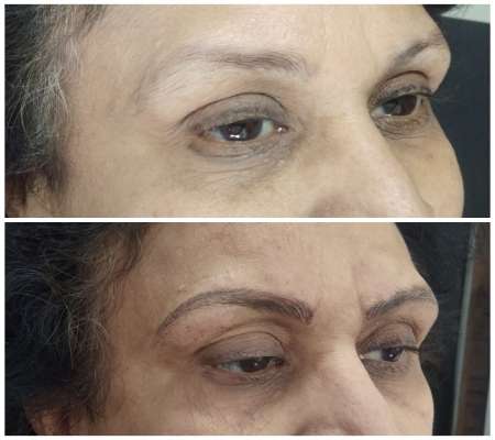 Microblading Eyebrows