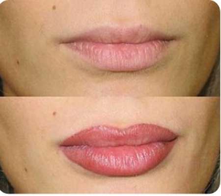 Permanent Lip Colour