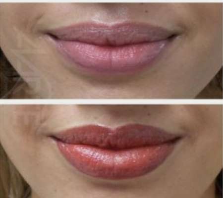 Permanent Lip Colour